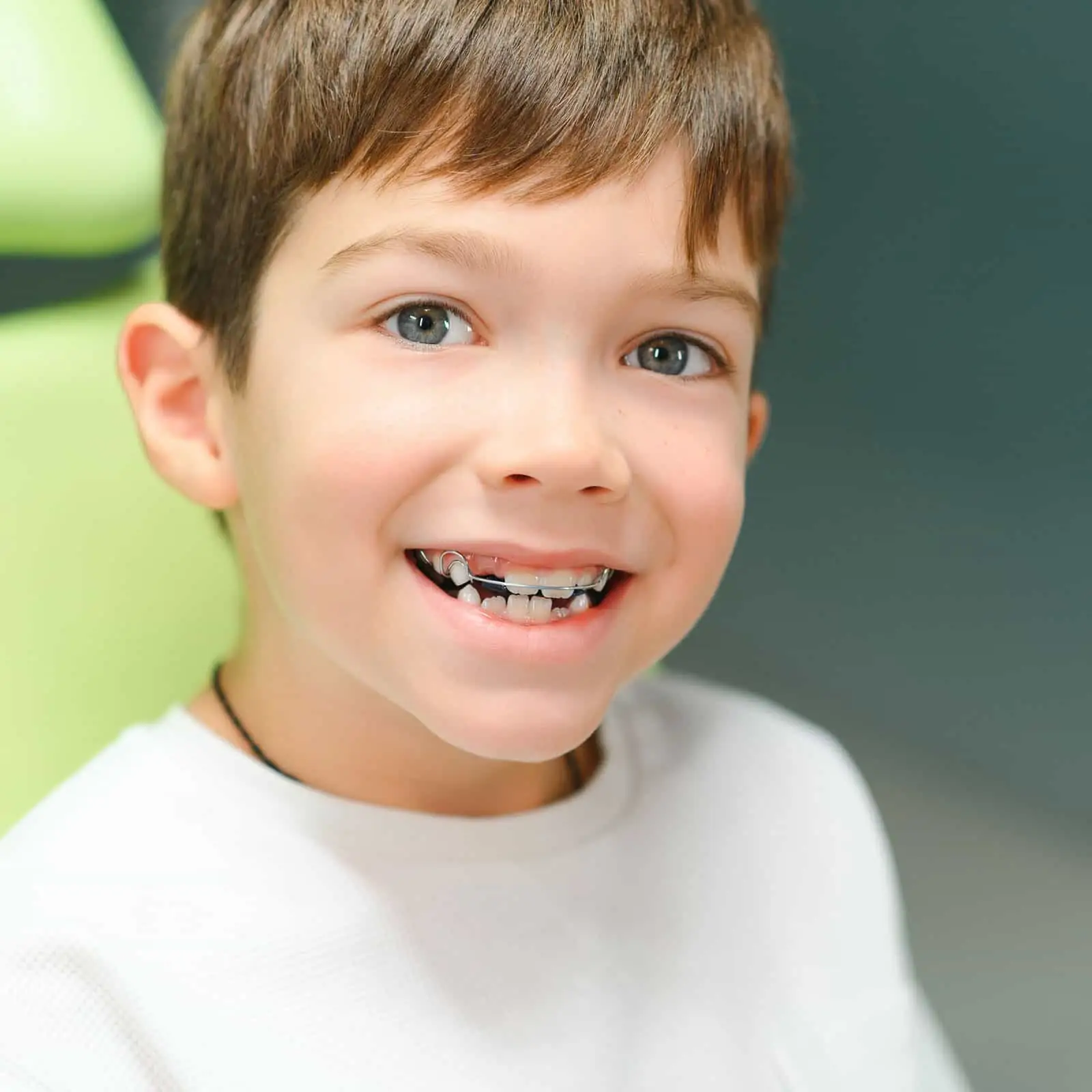 A young boy smiling with an early treatment appliance fitted on his upper teeth
